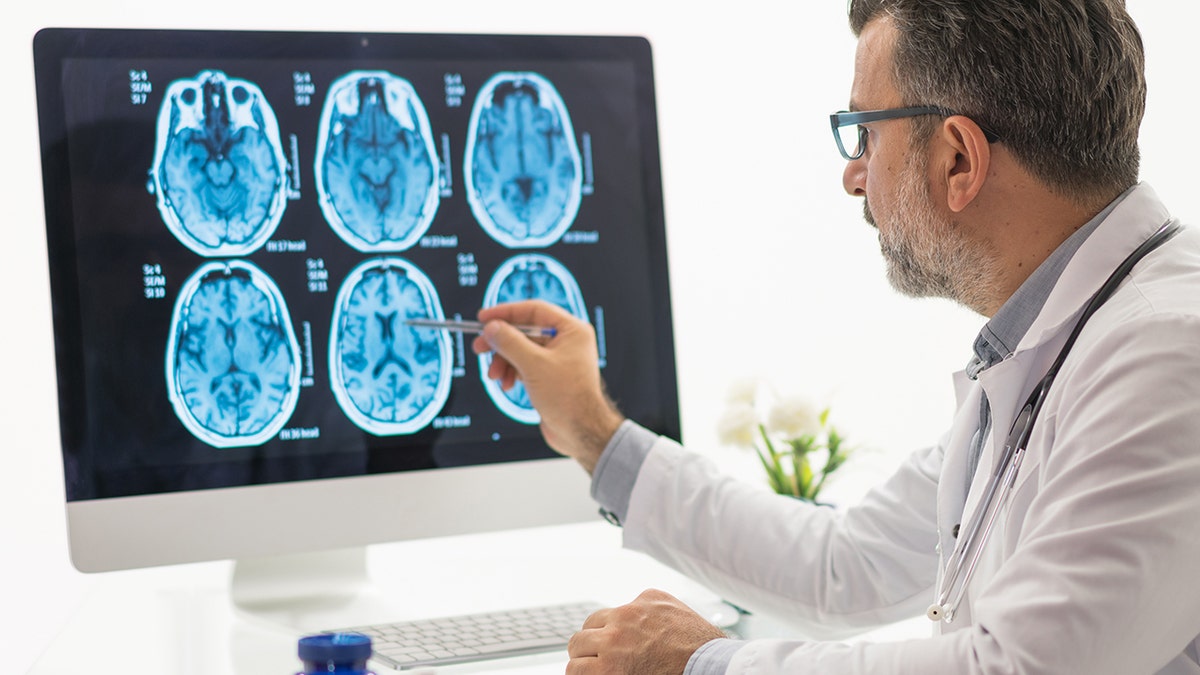 doctor examines brain scans