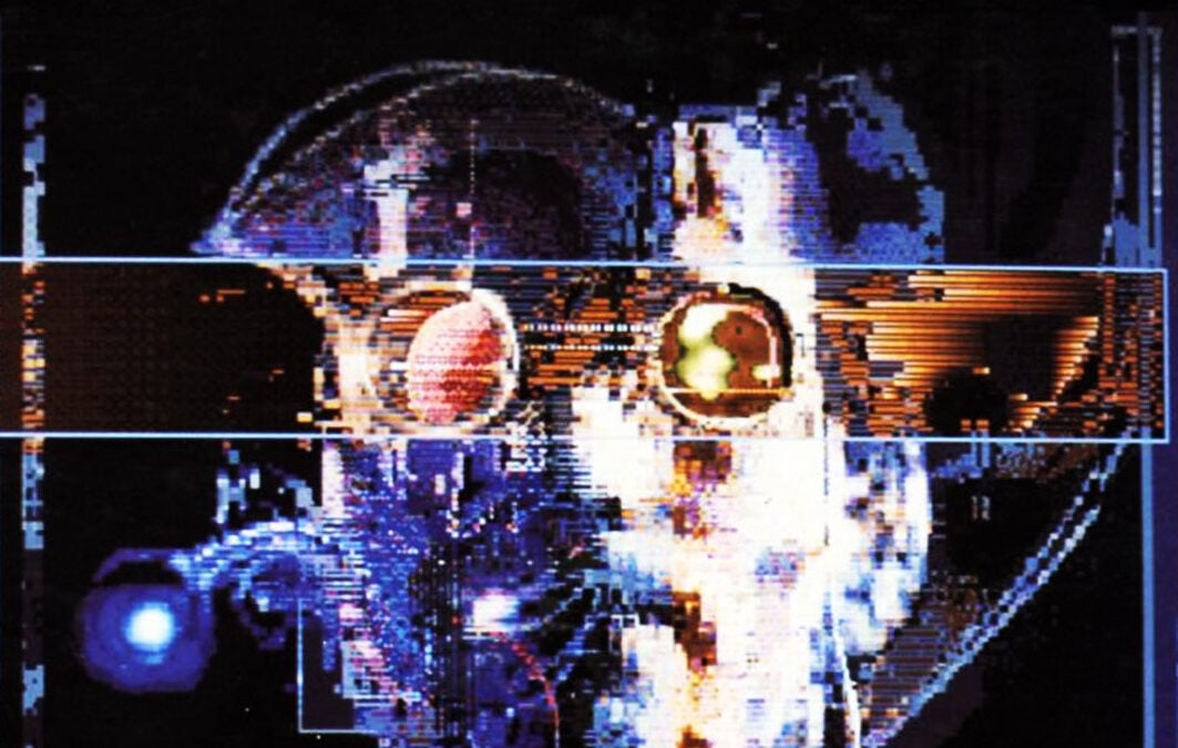 Decomp Hub Closes Due To AI, Mourns Sense Of Community