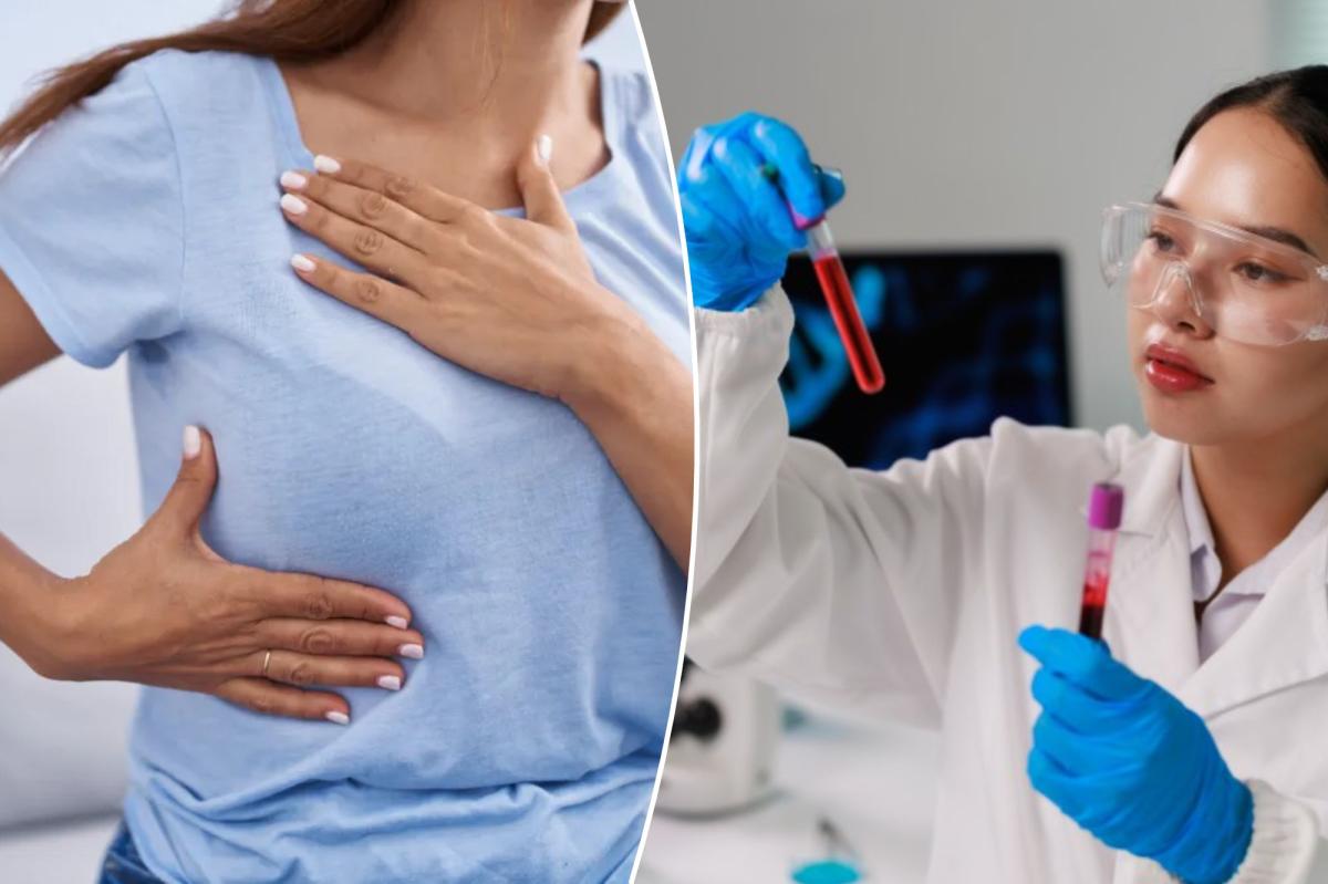 Old BRCA tests may have missed a cancer-linked mutation