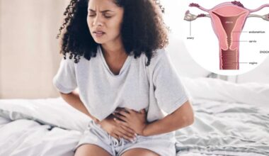 What are the lesser-known symptoms of endometriosis
