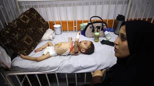 A Palestinian mother holds her child who suffers from malnutrition while she brings him to the Patient Friends Association Hospital in Gaza City