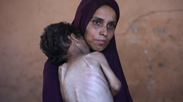 Naeema, a Palestinian mother, carries her malnourished two-year-old son, Yazan