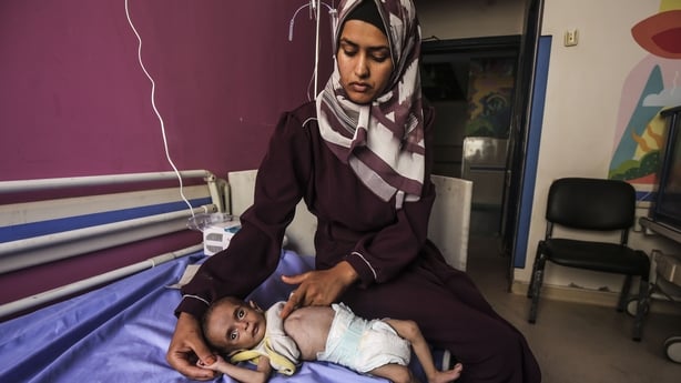An exhausted, weak and malnourished child is seen alongside his mother in Gaza