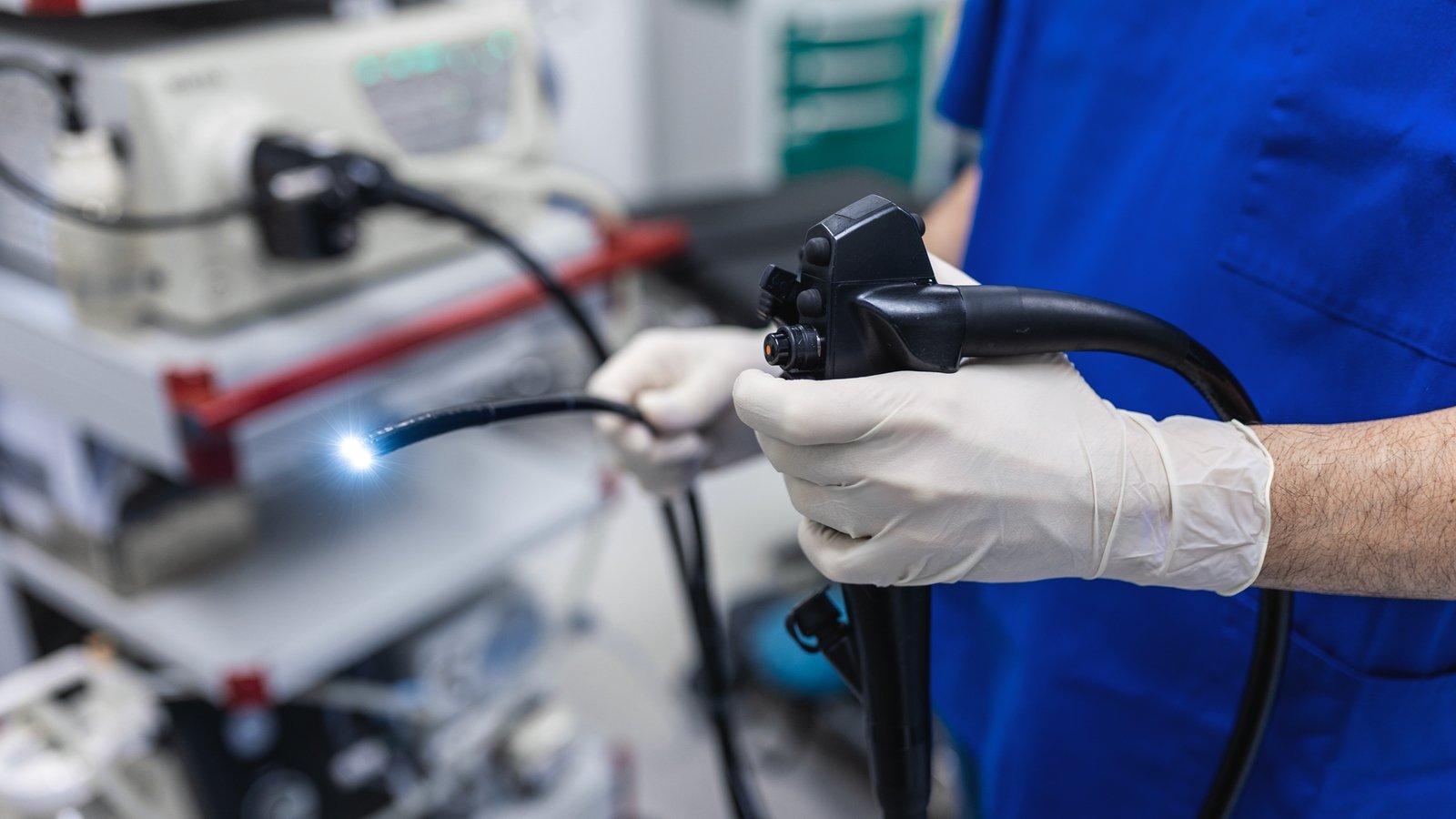 2,700 wait over HSE timeframe for urgent colonoscopy