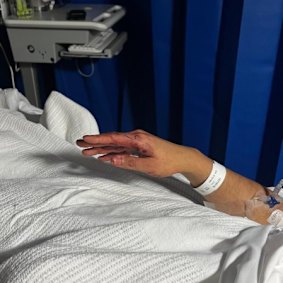 The injuries to one of Anand’s hands.