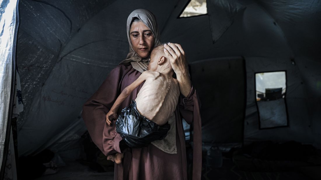 Photos: Starvation in Gaza
