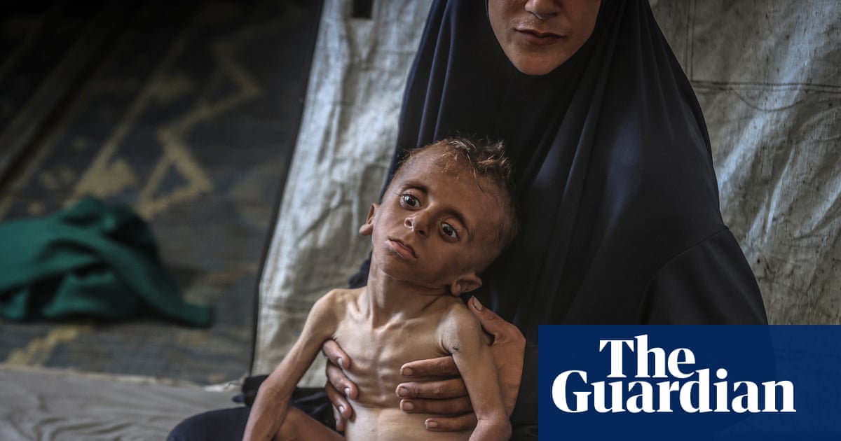 Severe malnutrition in under-5s has tripled at Gaza City clinic, charity reports | Gaza