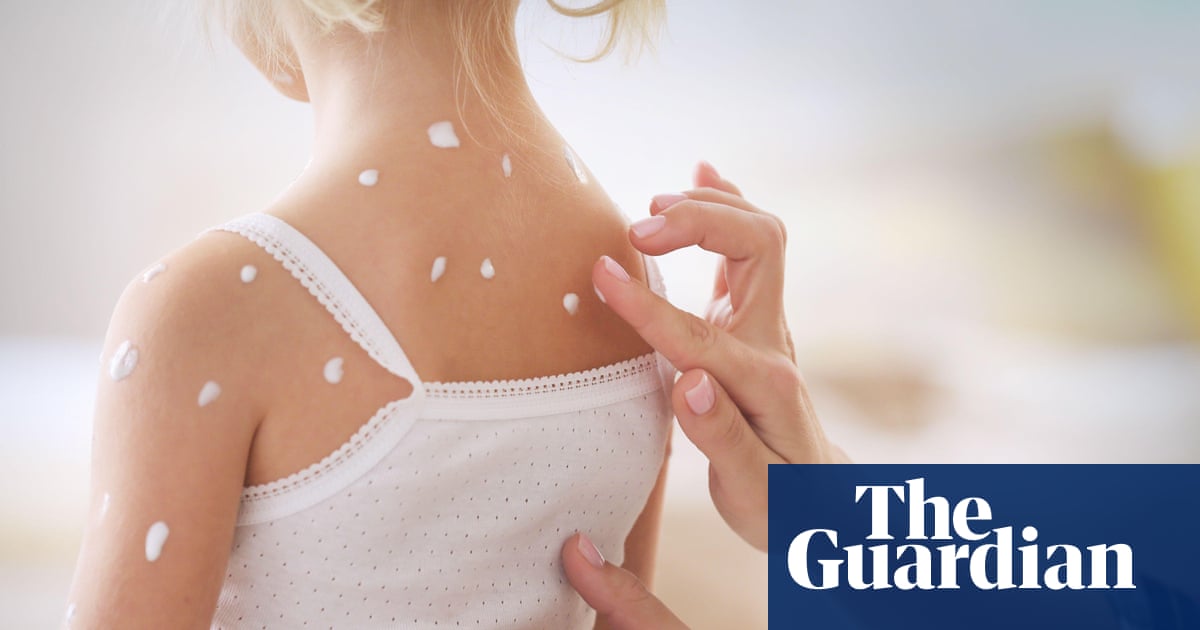 Sight of someone potentially infectious causes immune response, research suggests | Immunology