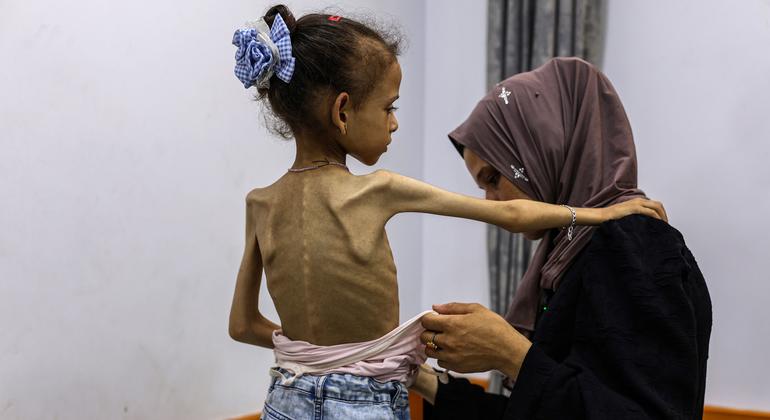 In Gaza, mounting evidence of famine and widespread starvation