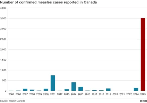 A graph showing the number of confirmed measles cases in Canada over the last 10 years, with 2025 being significantly higher than previous years.