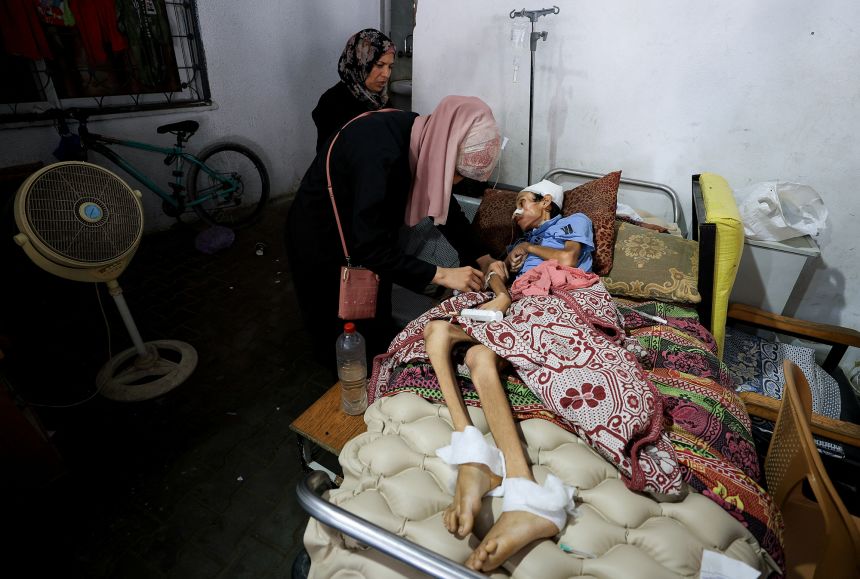 Palestinian boy Mosab Al-Debs, 14, who is malnourished according to medics, lies on a bed at Al-Shifa Hospital in Gaza City on July 22.