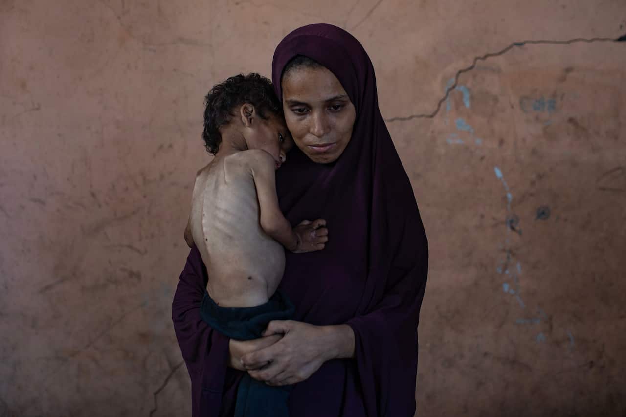 A mother holds her emaciated child