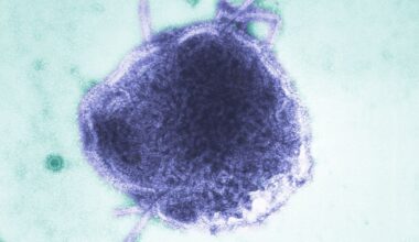 Day care measles exposure forces Iowa family to take weeks off work for baby: 'It only takes one'