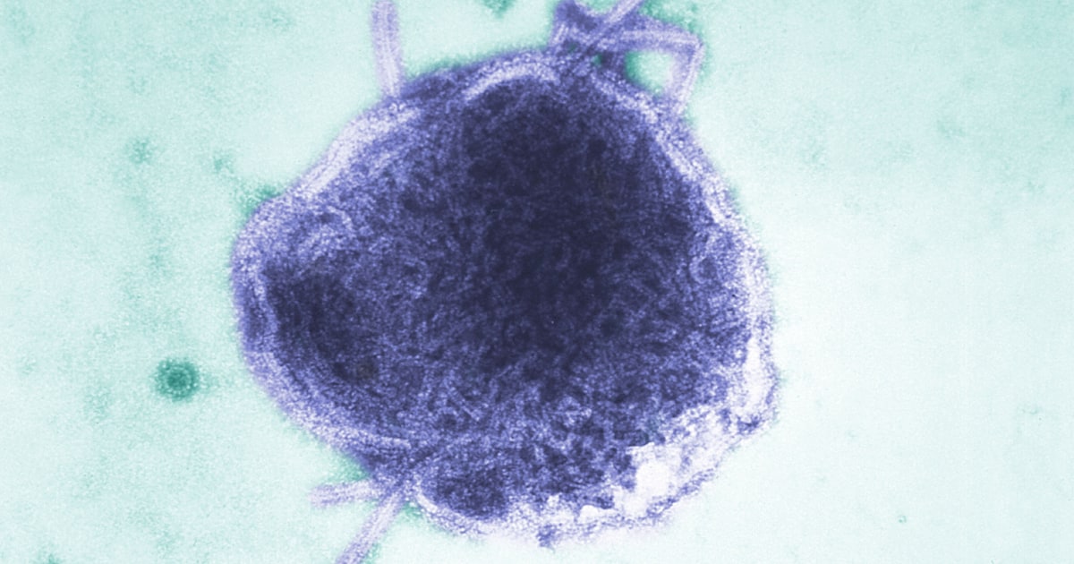 Day care measles exposure forces Iowa family to take weeks off work for baby: 'It only takes one'