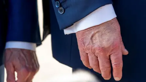 Reuters A close-up of the back of Trump's hand, which has a clear patch of makeup on it below the pointer and middle finger knuckles