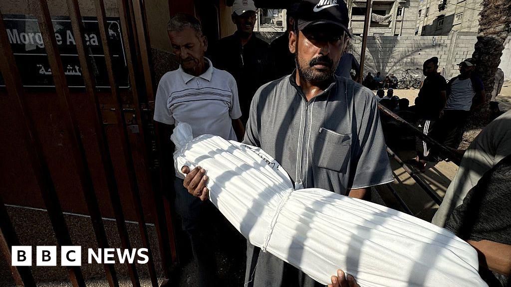 Gaza health ministry says 33 people died from malnutrition in 48 hours