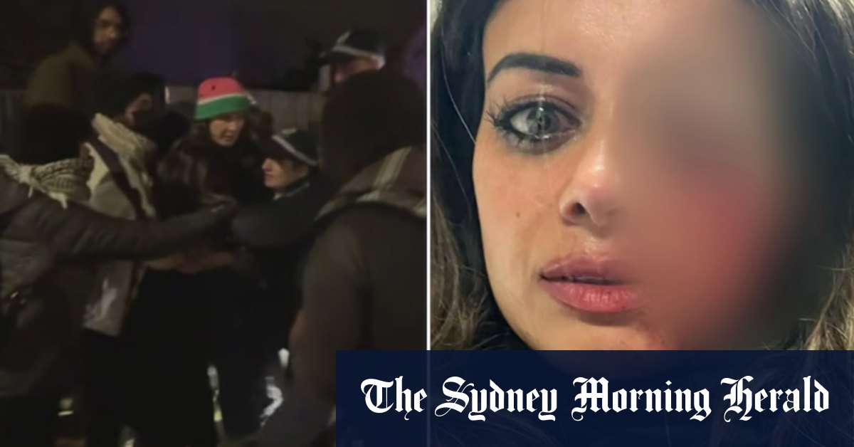 NSW Police probes ‘excessive force’ after Greens candidate sustains eye injury