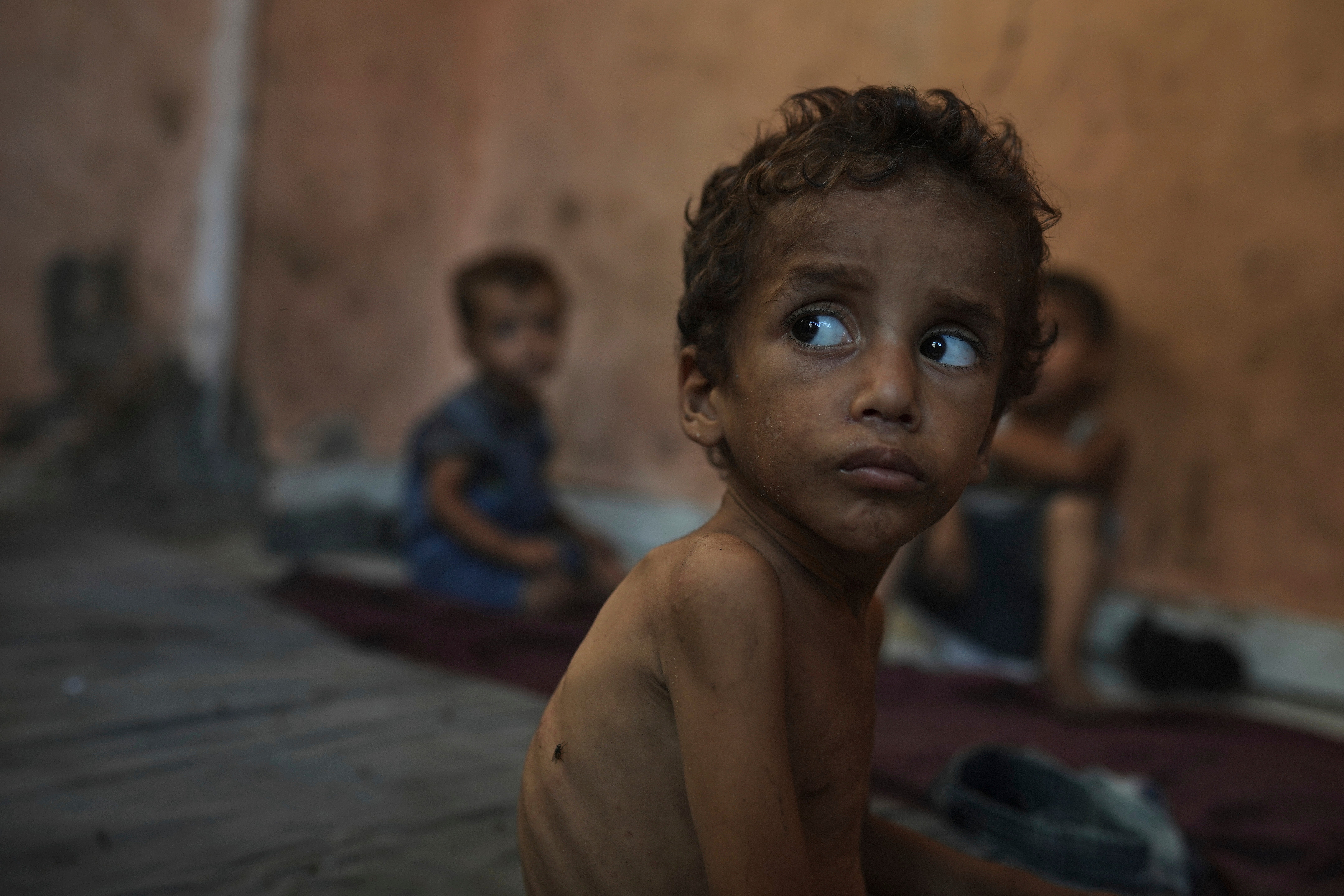 Yazan Abu Ful, a two-year-old malnourished child, sits at his family home in the Shati refugee camp in Gaza City on Wednesday, July 23, 2025. (AP Photo/Jehad Alshrafi)