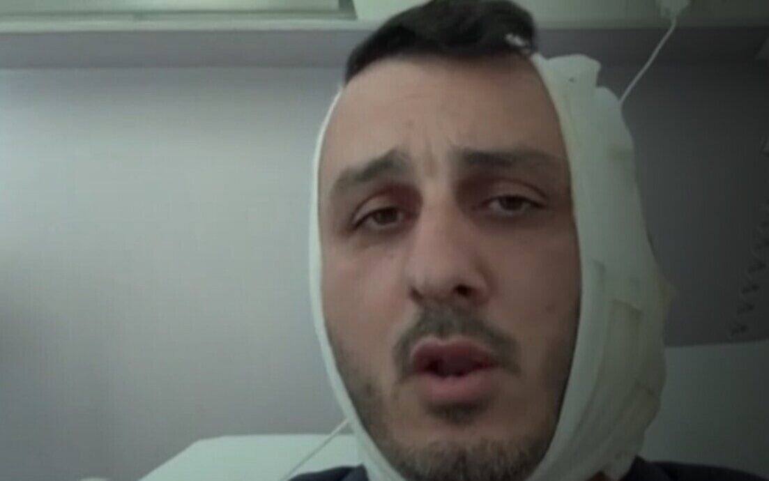 Israeli says man screamed 'F*ck Israel, I'm Hamas,' bit part of his ear off in Greece