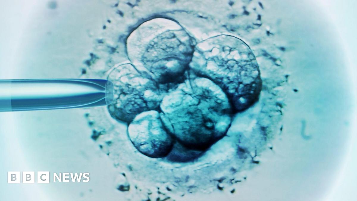 Embryo selection for IVF, light micrograph