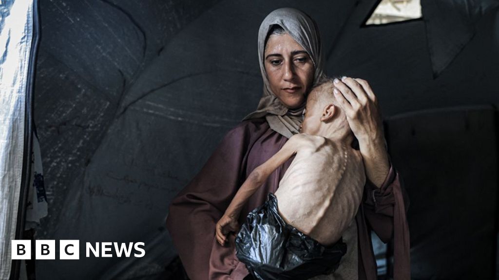The story behind the photograph of a starving Gaza baby