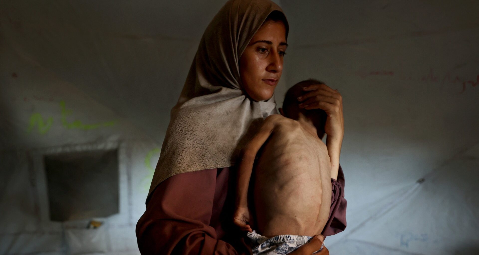 No, a Gaza toddler having cerebral palsy does not mean Israeli starvation is a ‘lie’