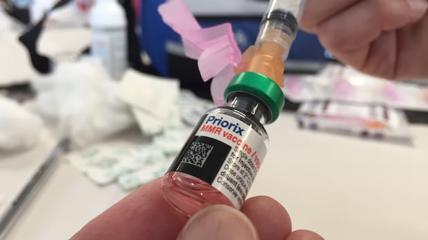 Measles out of control ahead of September school start, doctors warn