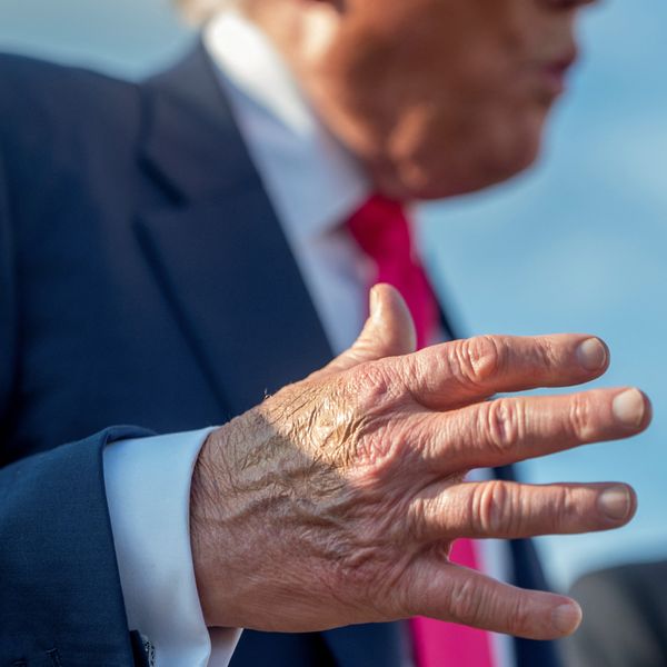 FILE PHOTO: Make-up partially covers the back of the right hand of U.S. President Donald Trump as he speaks to members of the media upon his