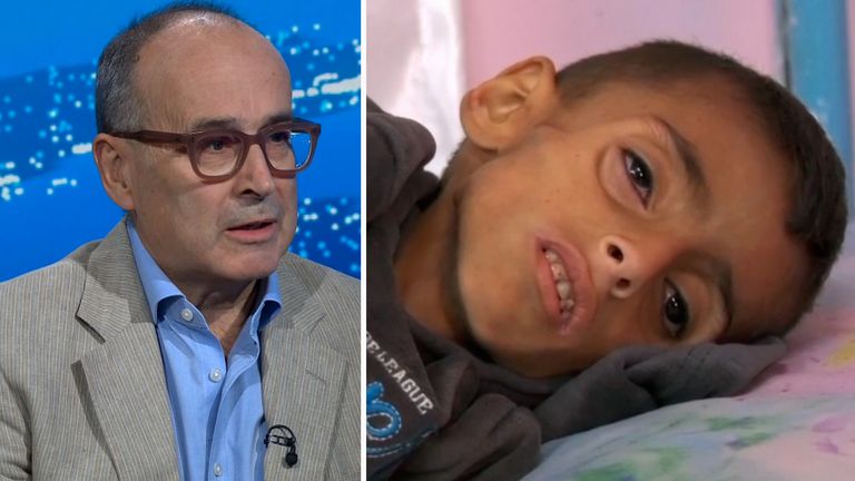 yalda hakim gaza doctor surgeon malnutrition famine maynard