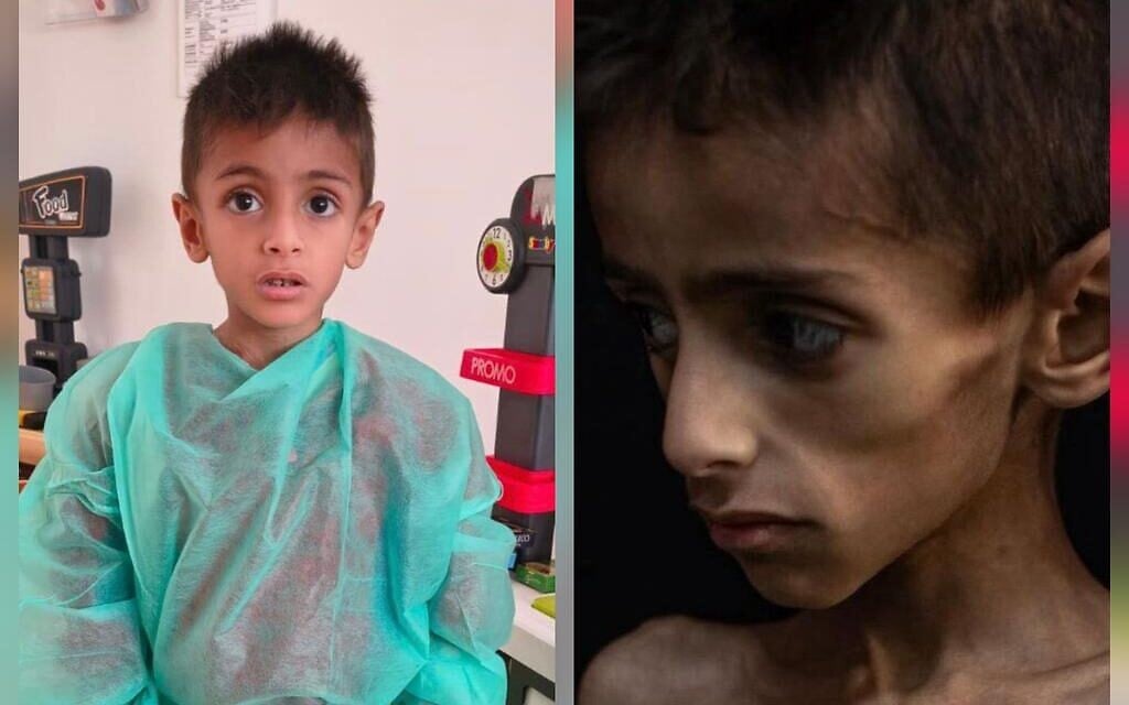 Image of Gazan child with genetic illness being used to falsely smear Israel, COGAT charges