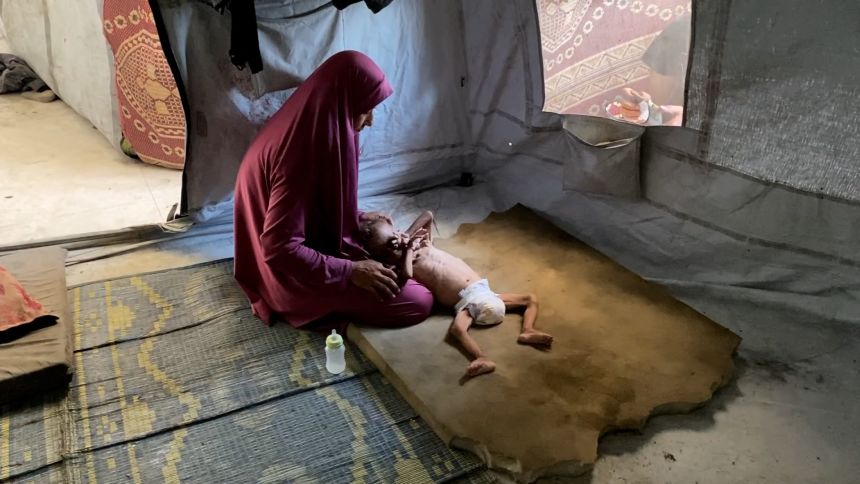 Hidaya Al Mtawwaq cares for her son Mohammad in Gaza City on July 25.