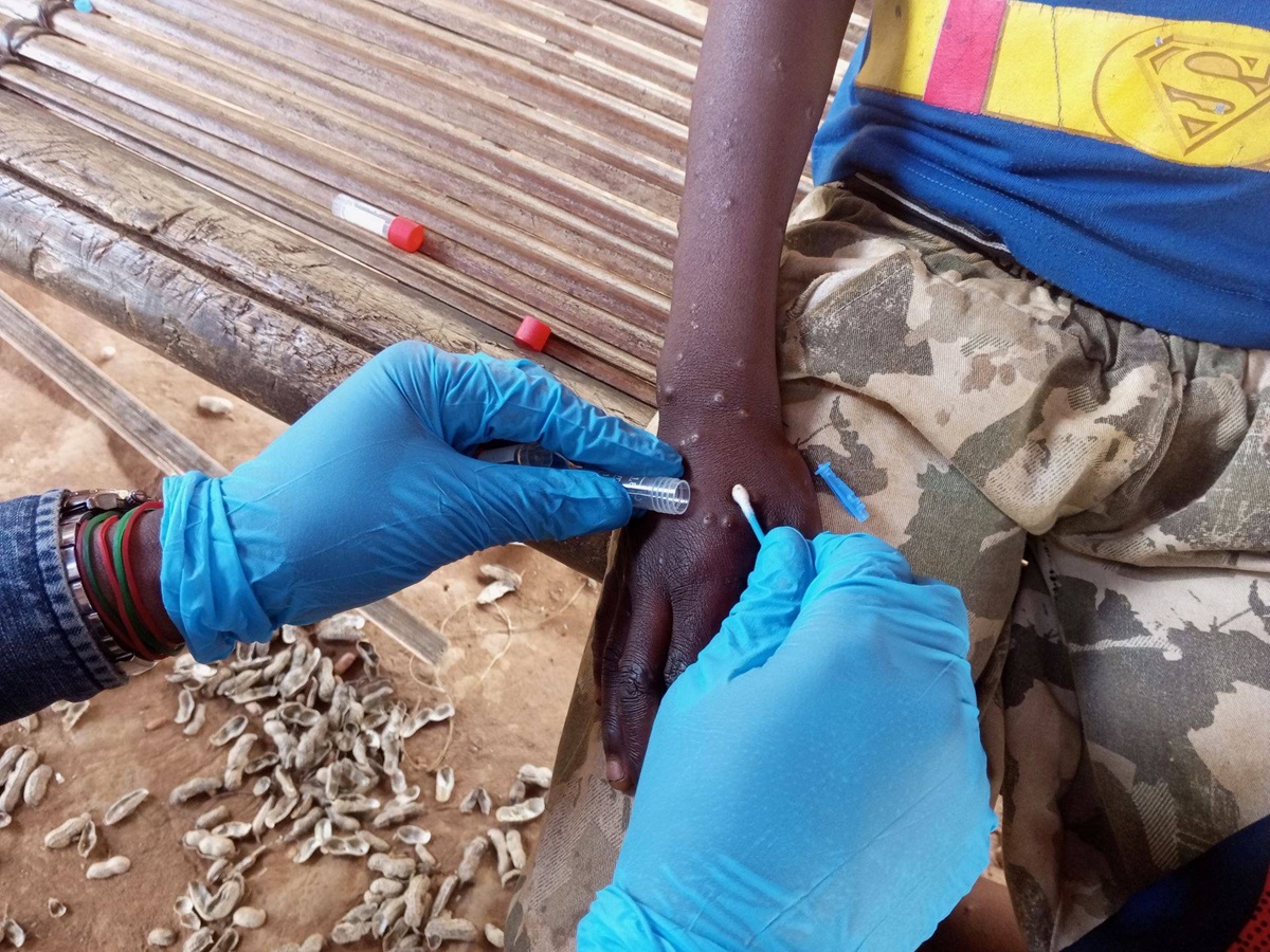 Integrating HIV/syphilis/mpox testing – from theory to practice