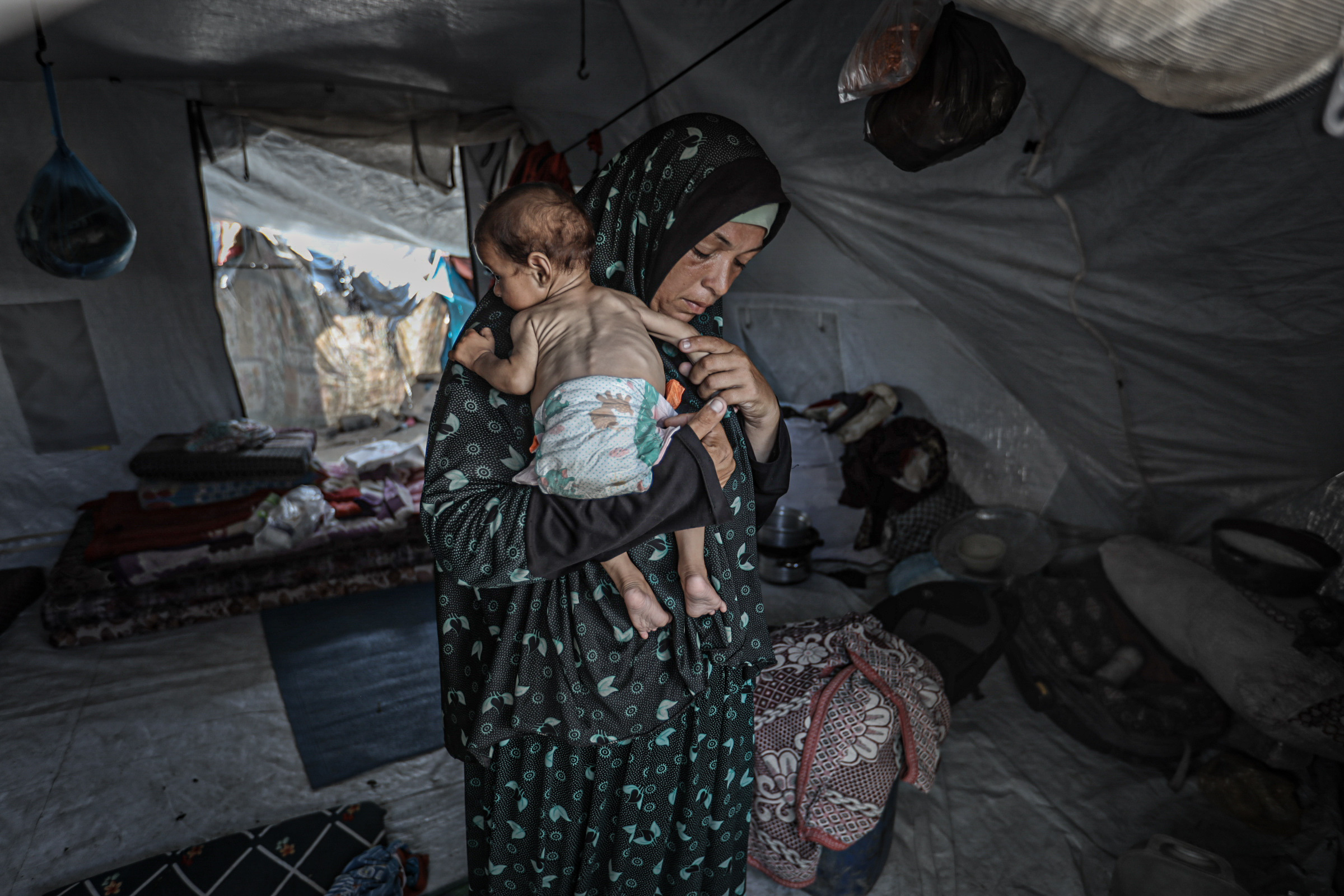 Severely malnourished infant in a Gaza City tent, surviving on water due to the Israeli blockade.