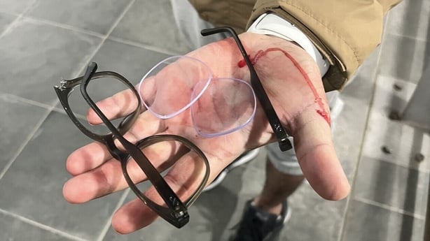 An attack on Dr Santosh Yadav in Dublin left him with a fractured cheekbone and other injuries all over his body.