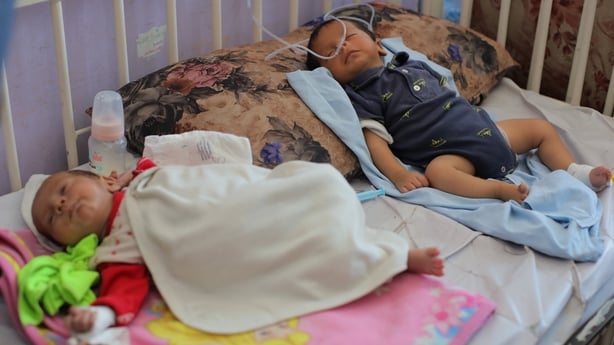 Two children suffering from malnutrition are seen lying in a bed undergoing medical treatment