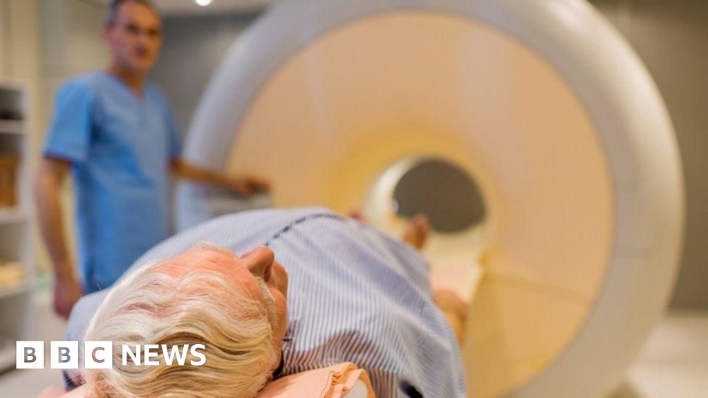 Men being over-treated for prostate cancer, says charity