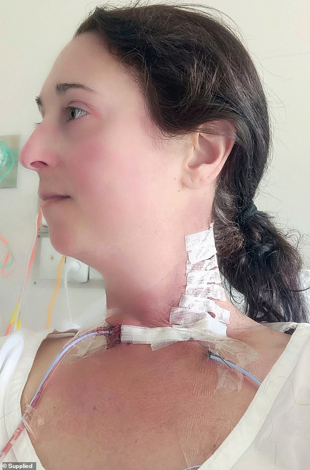 After her long-time GP dismissed her saying she was 'just getting old.' Deborah sought a second opinion which revealed a three-centimetre mass on her thyroid