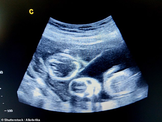 Courteney Williams was shocked to find one baby actually belongs to her