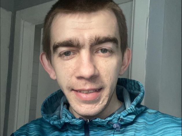 Face of Dublin man accused of strangling woman during assault in his home