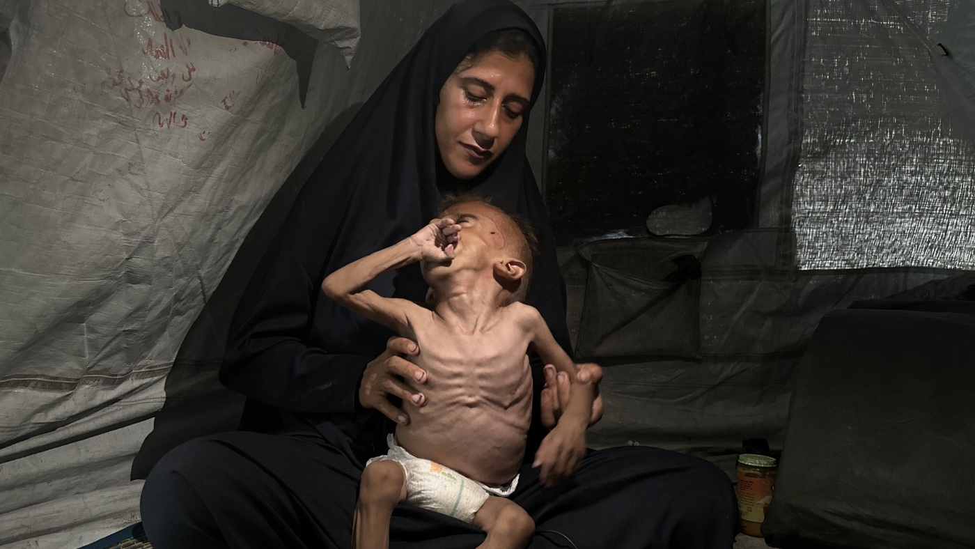 The Story Behind a Famous Photo of a Starving Child in Gaza - NPR