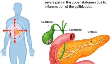 Gallbladder and fatty liver nutritionist shares 8 things to do if you 'battle back to back gallbladder attacks' | Health