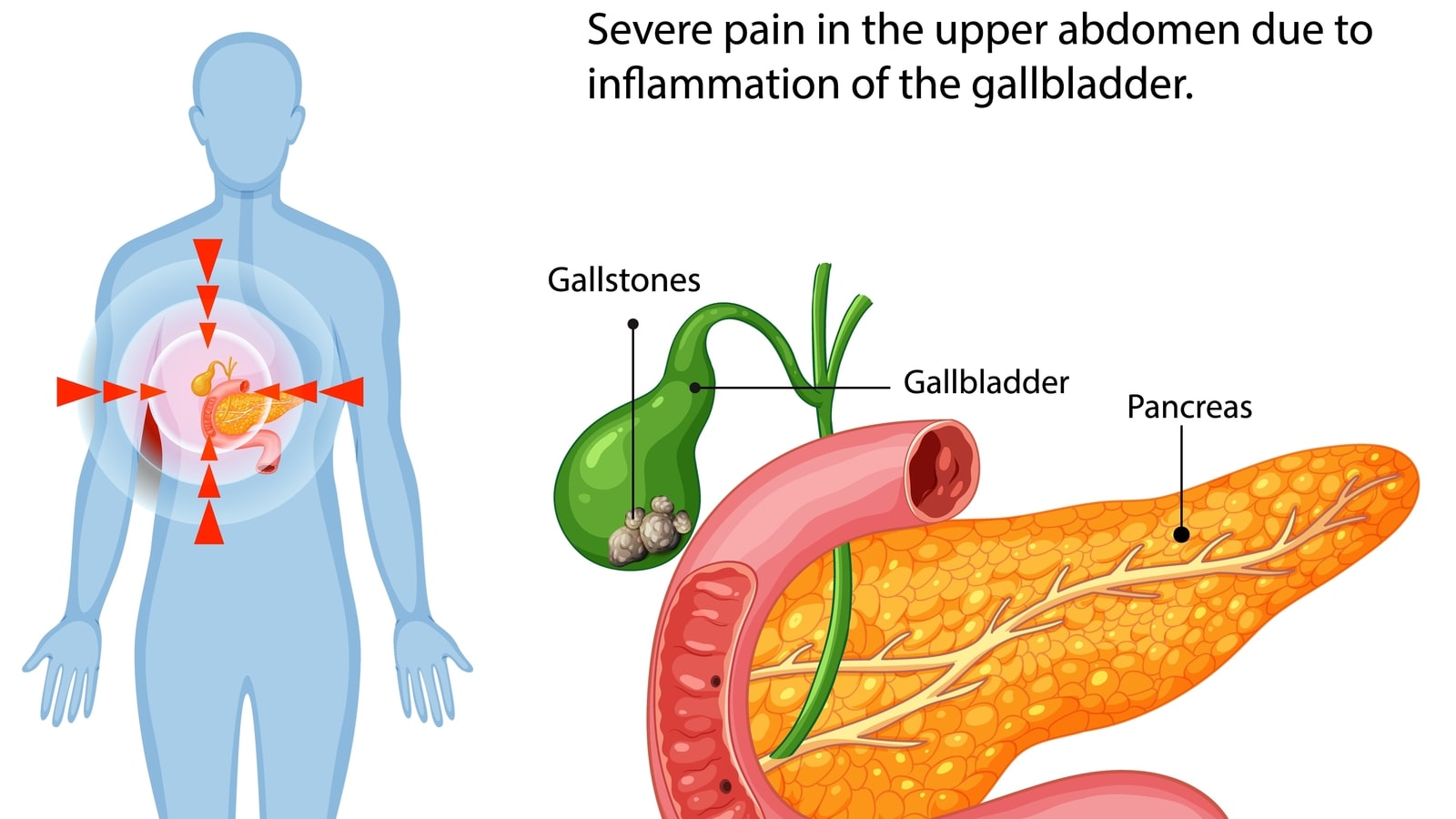 Gallbladder and fatty liver nutritionist shares 8 things to do if you 'battle back to back gallbladder attacks' | Health