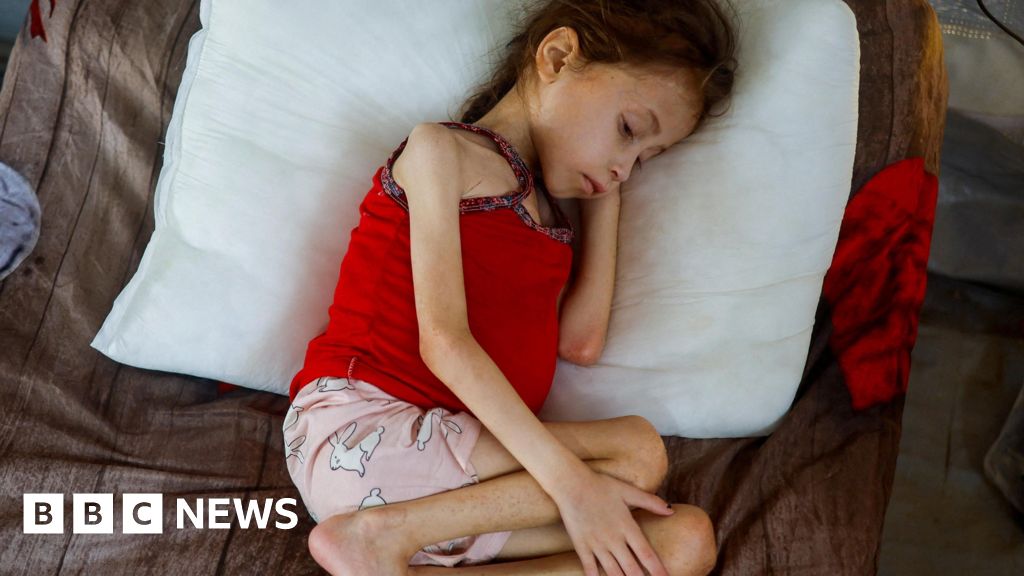 MPs call on government to bring sick and injured Gaza children to UK