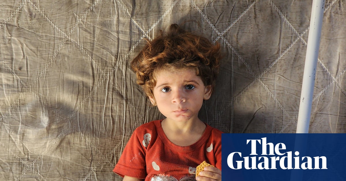 ‘Very sick and very tired’: the reality of famine for Gaza’s most vulnerable | Israel-Gaza war