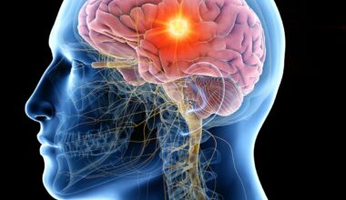 Vorasidenib for the Treatment of Astrocytoma/Oligodendroglioma