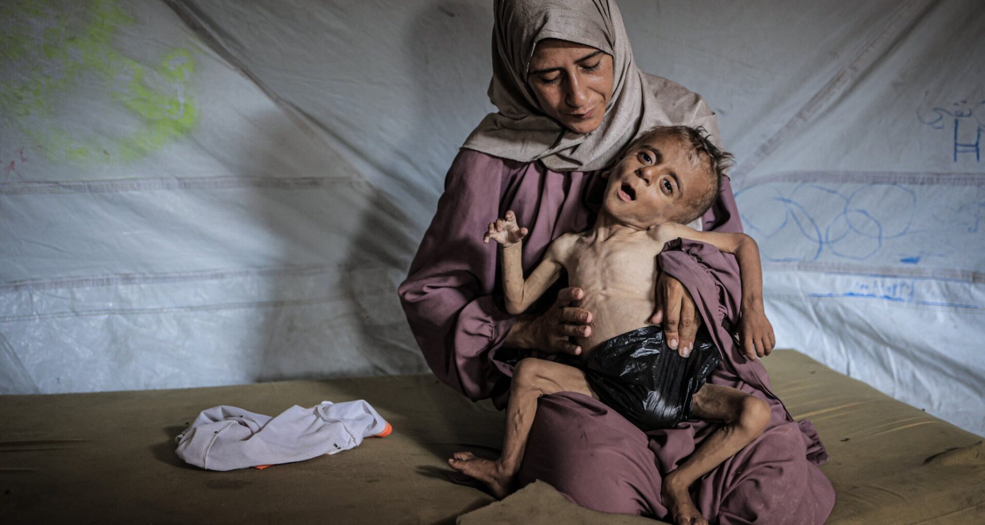 'We never see kids like this:' Israeli doctors speak out on emaciated Gazan children