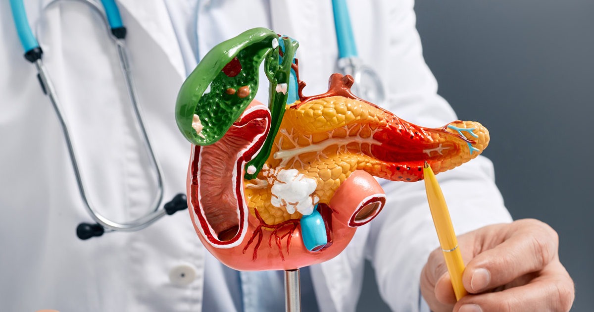 Pancreatic cancer vaccine prevents recurrence in Phase 1 clinical trial