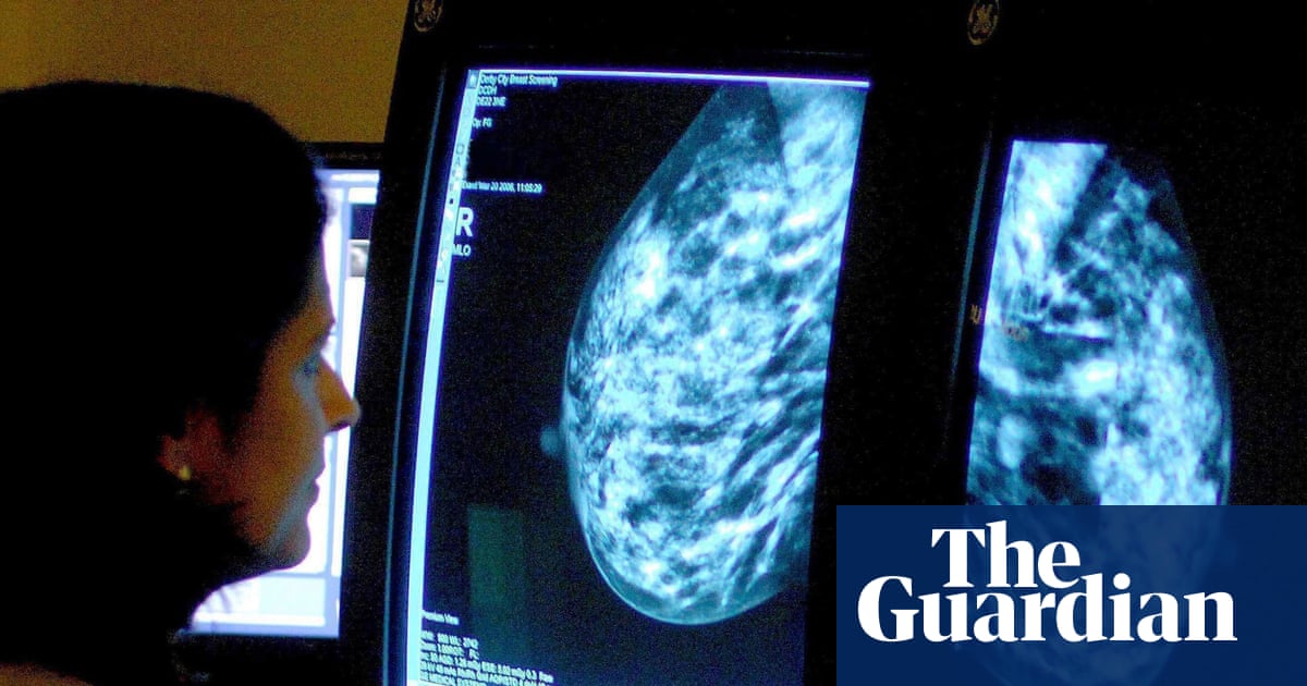 Cancer charities call for earlier diagnosis as cases projected to surge in England by 2040 | Cancer