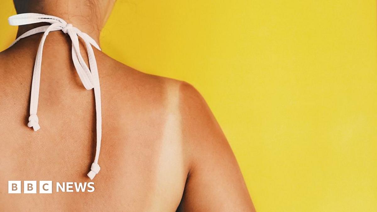 Tan lines on a woman's back. She has white straps around her neck and is standing in front of a yellow background.