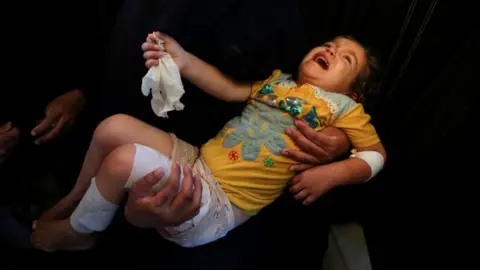 Reuters An injured toddler cries as they are being carried with bandages over their arm and legs
